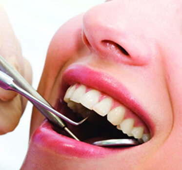 endodoncia dentista cunit