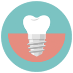 implante dentista cunit