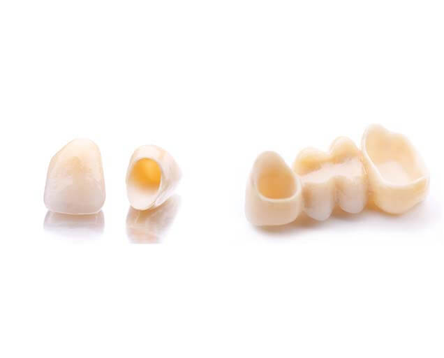 Odontología sin metal – Clínica Dental rocabayera